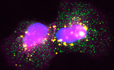 From neuronal polarization to function: unveiling the transport and function of neuronal surface receptors